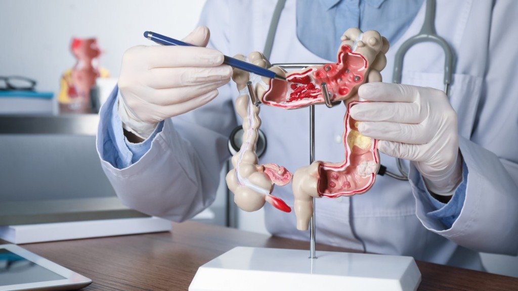 Understanding Colorectal Procedures
