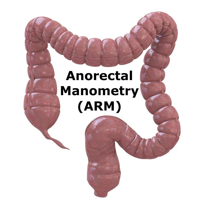 Understanding Anorectal Conditions
